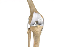 Knee Cartilage Restoration