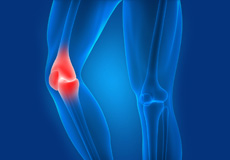 Knee Sports Injuries