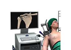 Minimally Invasive Shoulder Joint Replacement