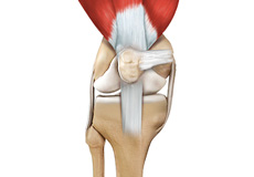 Quadriceps Tendon Repair