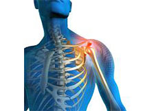 Shoulder Pain